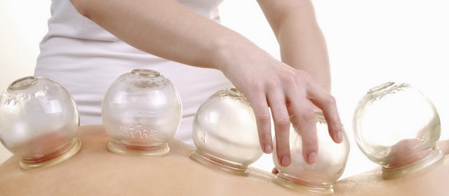 Cupping